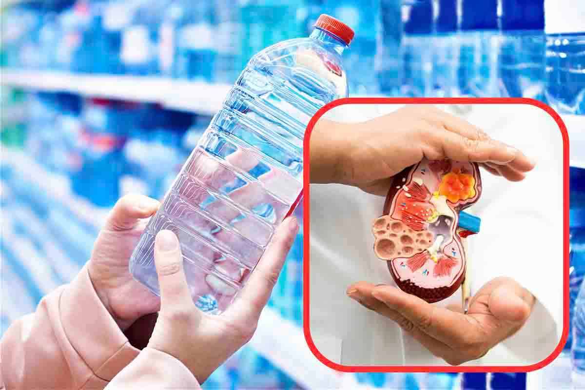 Quale acqua in bottiglia scegliere per la salute dei reni
